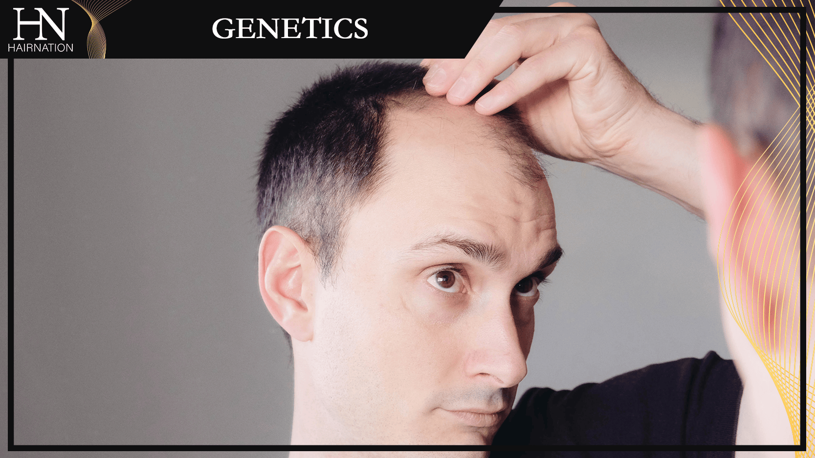 Best Genetic Hair Loss Treatment Hair Loss Clinic HairNation Calgary