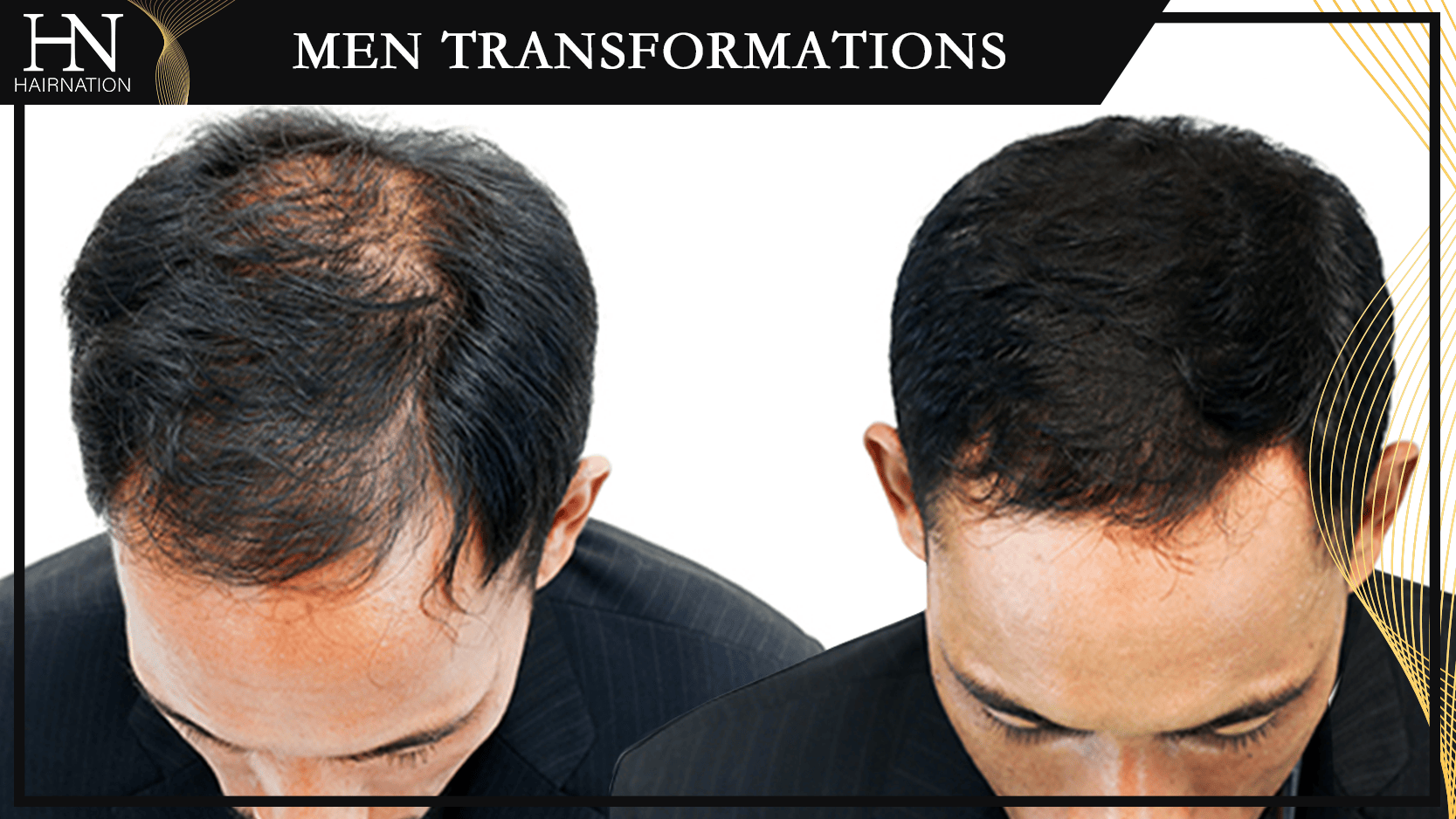 Men's Transformations