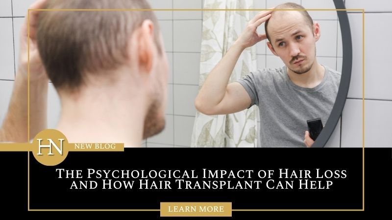 The Psychological Impact of Hair Loss and How Hair Transplant Can Help