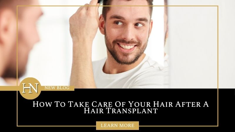 How To Take Care Of Your Hair After A Hair Transplant