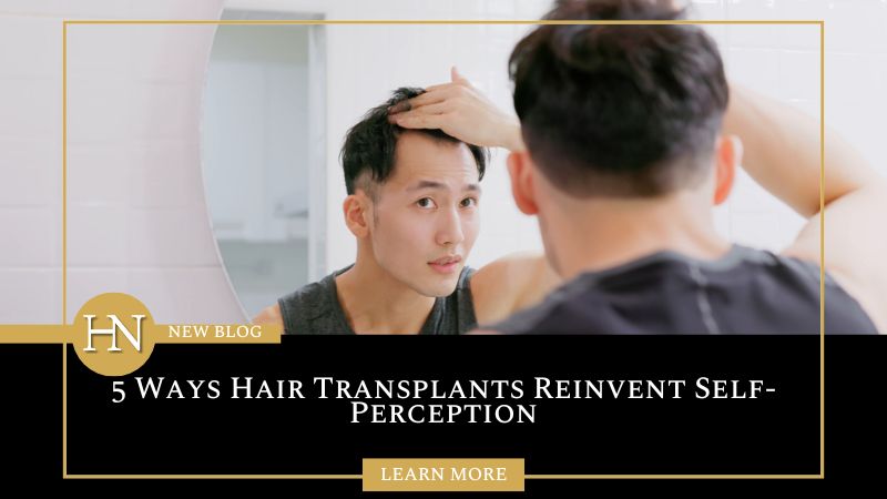 5 Ways Hair Transplants Reinvent Self-Perception