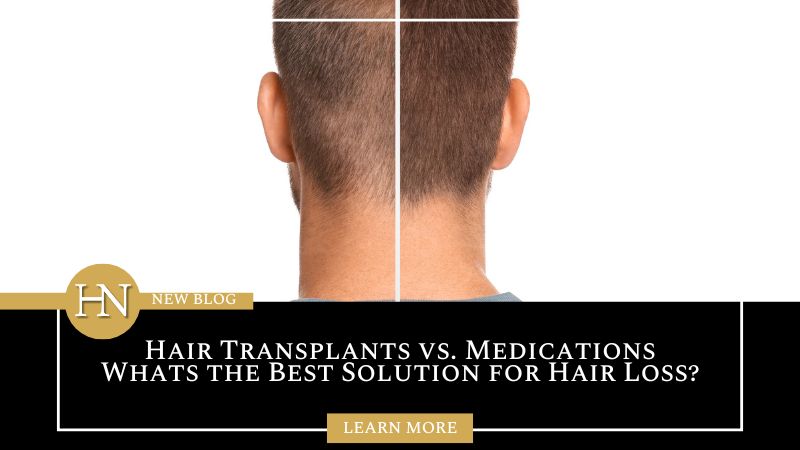 Edmonton Hair Transplants vs. Medications: What’s the Best Solution for Hair Loss?