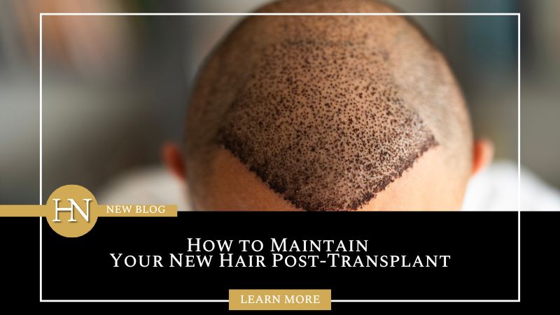 Vancouver Hair Transplant: How to Maintain Your New Hair Post-Transplant