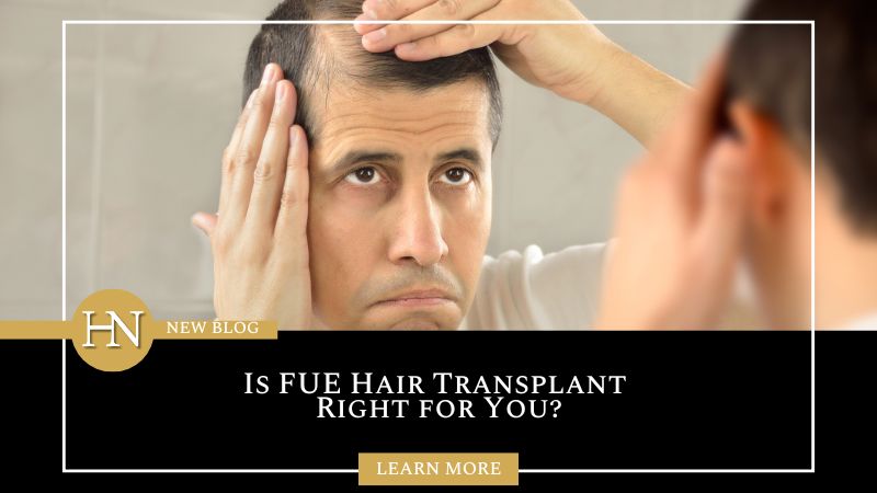 Edmonton FUE Treatment: Is FUE Hair Transplant Right for You?