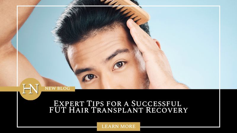 Edmonton FUT Treatment: Expert Tips for a Successful FUT Hair Transplant Recovery