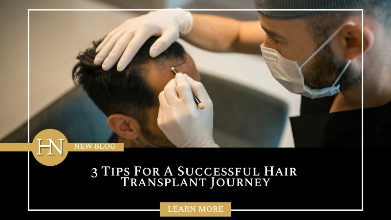 Vancouver Hair Transplant: 3 Tips For A Successful Hair Transplant Journey