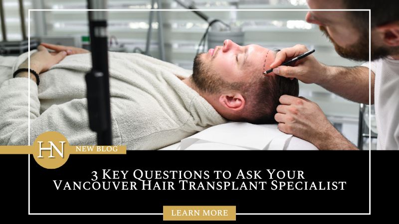 3 Key Questions to Ask Your Vancouver Hair Transplant Specialist