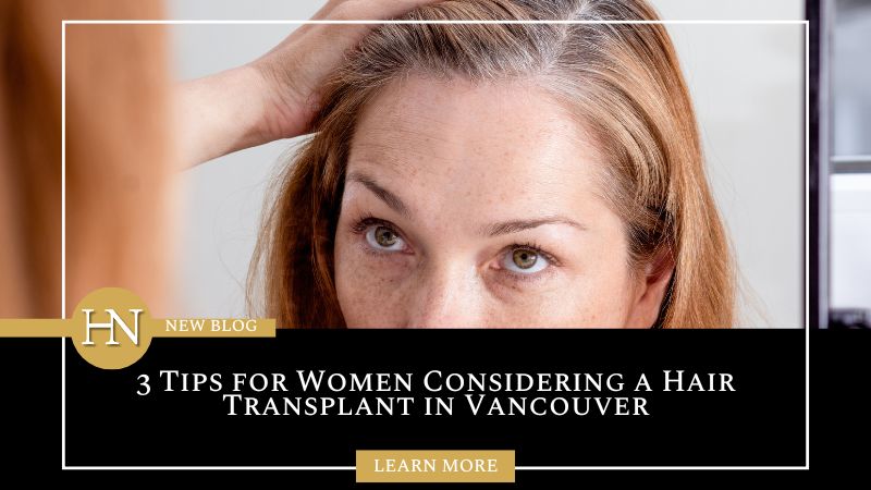 3 Tips for Women Considering a Hair Transplant in Vancouver