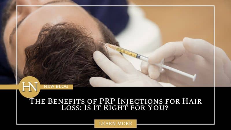 The Benefits of Injections for Hair Loss: Is It Right for You?