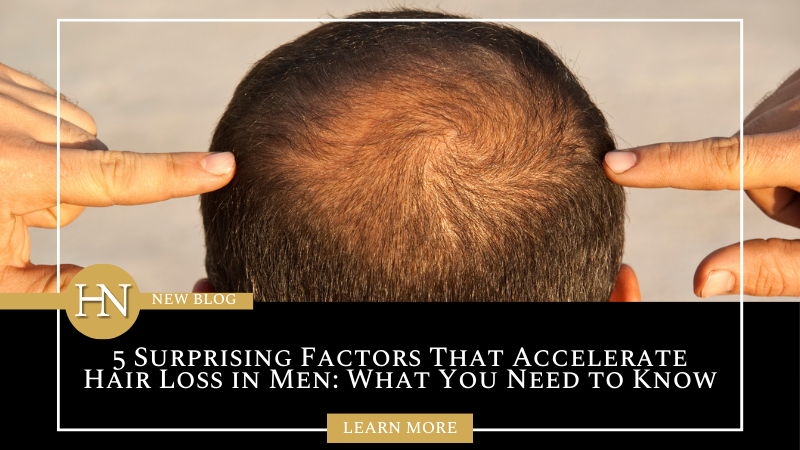 5 Surprising Factors That Accelerate Hair Loss in Men: What You Need to Know