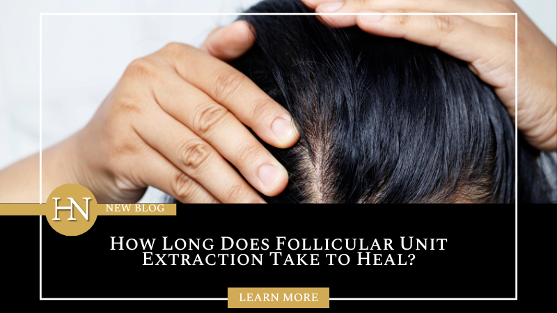 How Long Does Follicular Unit Extraction Take to Heal?