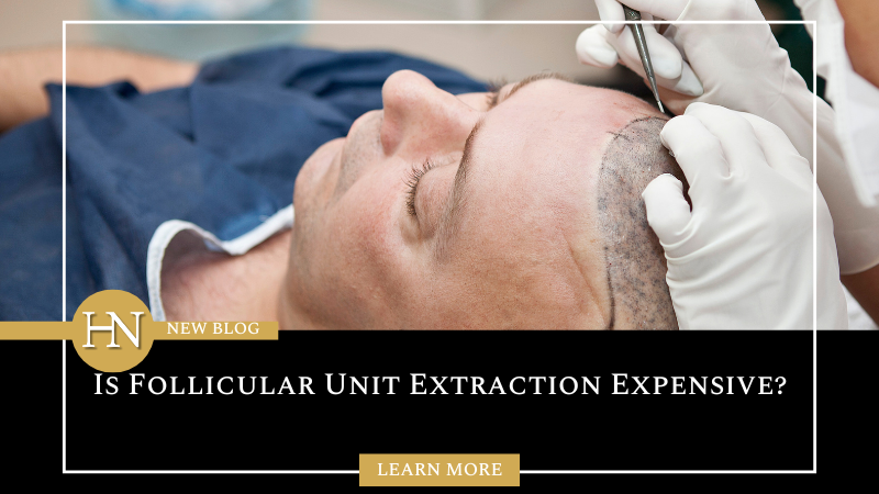 Is Follicular Unit Extraction Expensive?