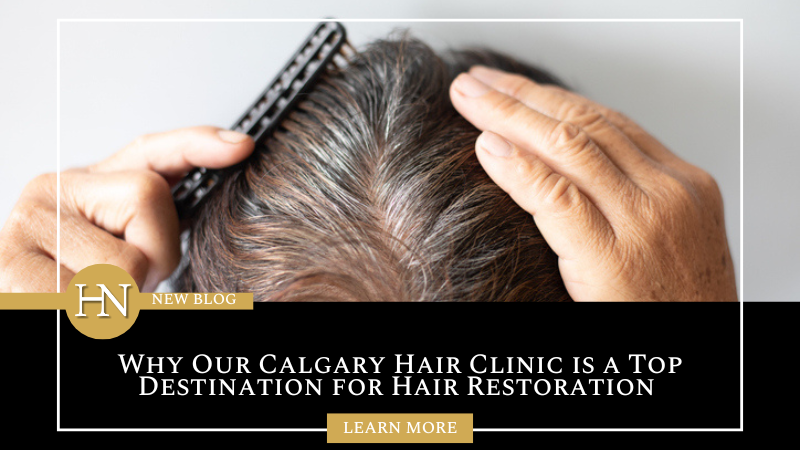 Why Our Calgary Hair Clinic is a Top Destination for Hair Restoration