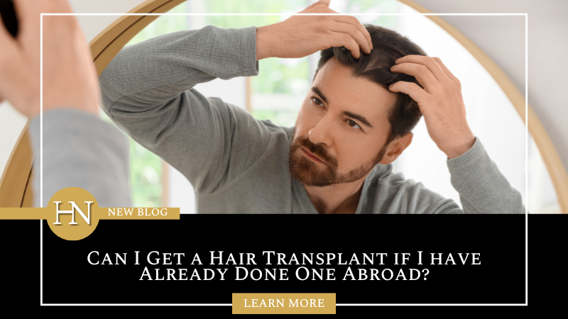 Can I Get a Hair Transplant if I have Already Done One Abroad?