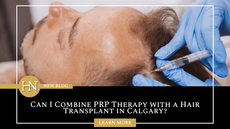 Can I Combine PRP Therapy with a Hair Transplant in Calgary?
