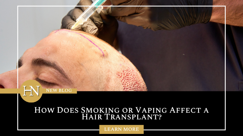 How Does Smoking or Vaping Affect a Hair Transplant?
