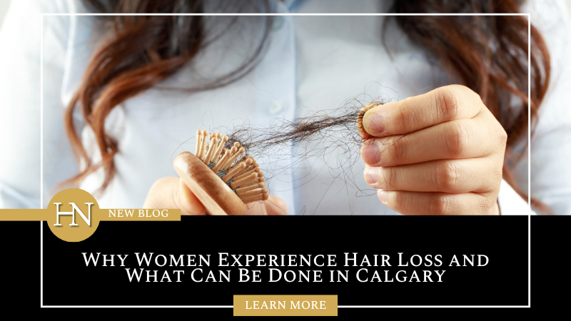 Why Women Experience Hair Loss and What Can Be Done in Calgary