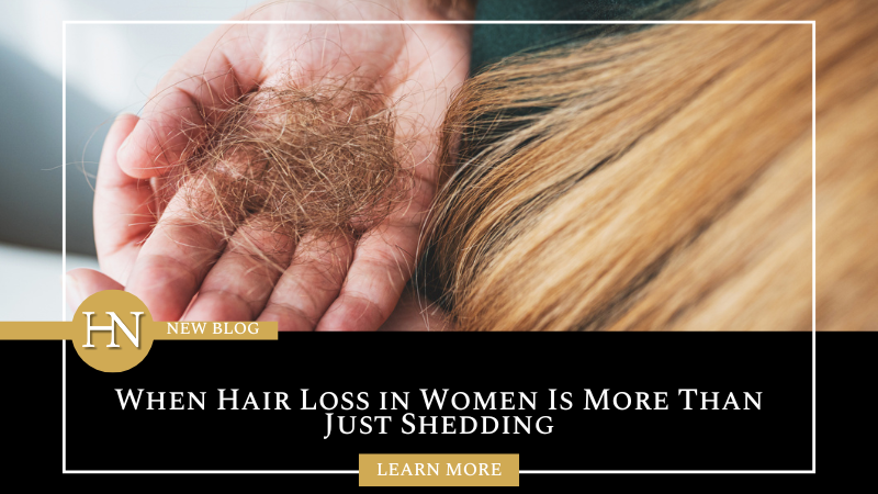 When Hair Loss in Women Is More Than Just Shedding