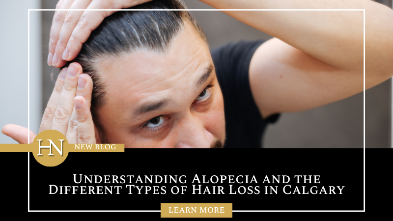 Understanding Alopecia and the Different Types of Hair Loss in Calgary