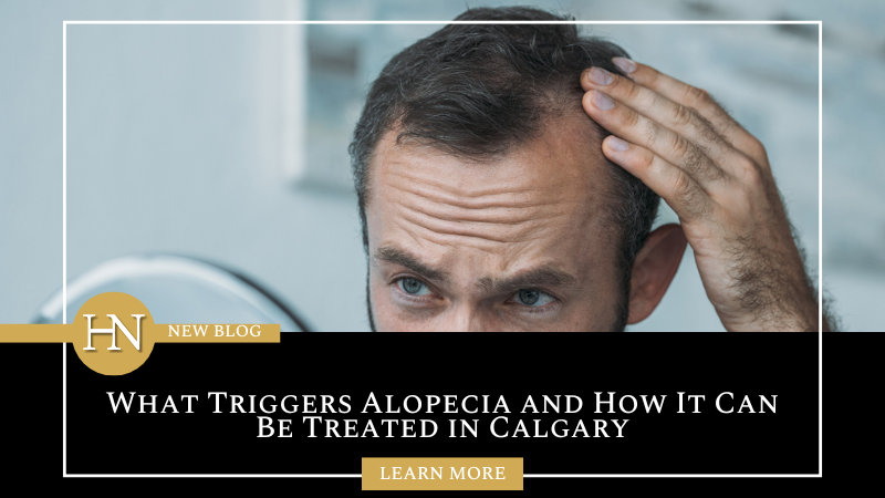 What Triggers Alopecia and How It Can Be Treated in Calgary