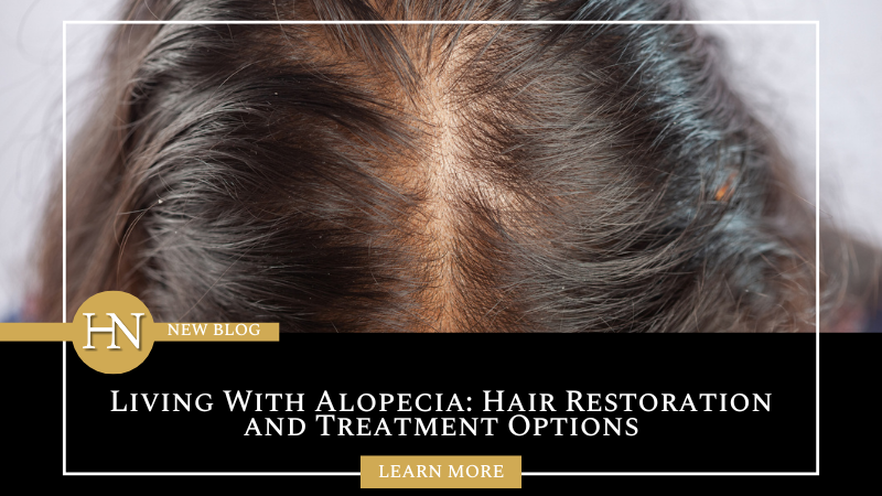 Living With Alopecia: Hair Restoration and Treatment Options