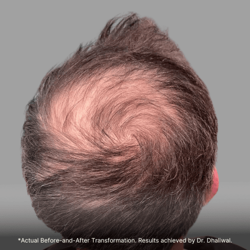 Set 5-HairNation-Before/After