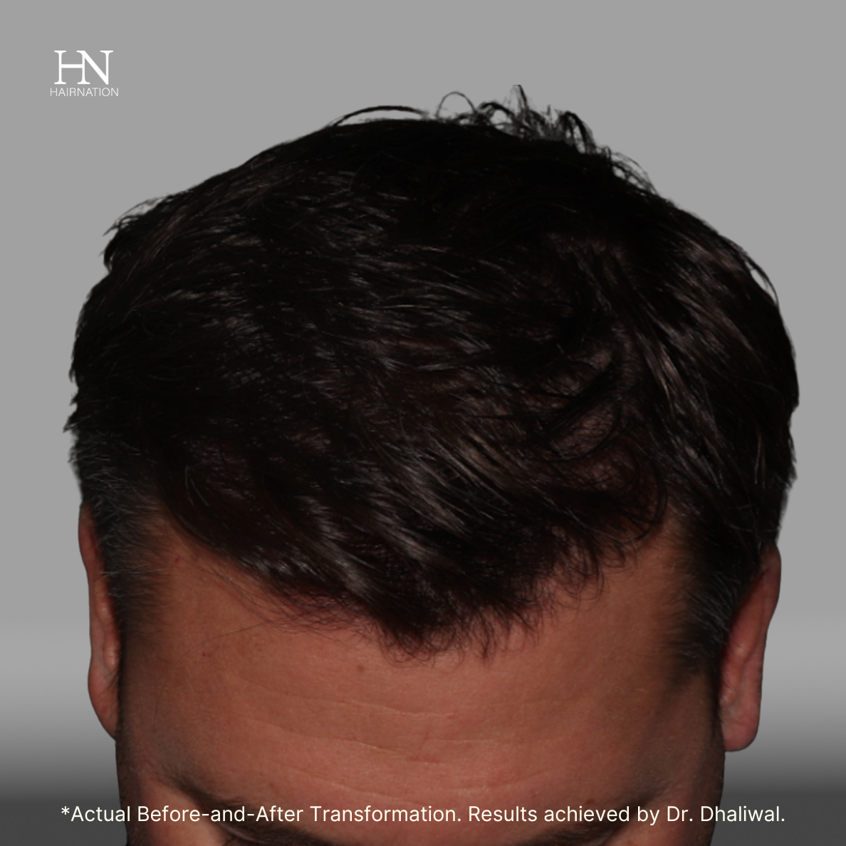 2C - Before/After